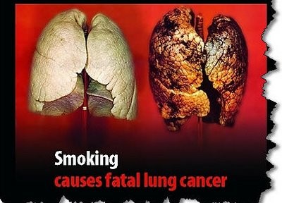 Raucherlunge auf Zigarettenpackung